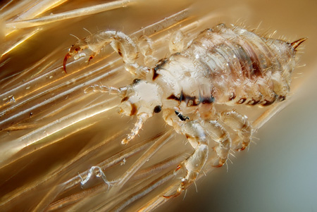 Facts on Head Lice